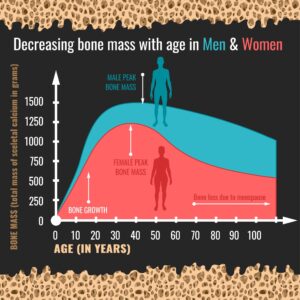 Bone desity by age