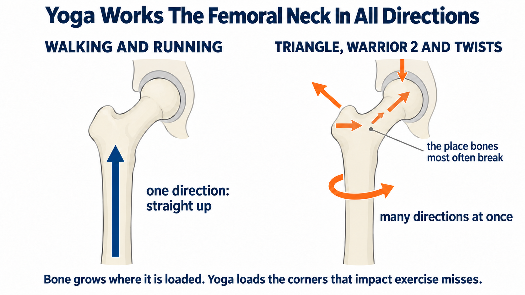 Isometric yoga for bone strength: a hip bone loaded in one direction by walking and running compared with many directions at once by Triangle, Warrior 2 and twists