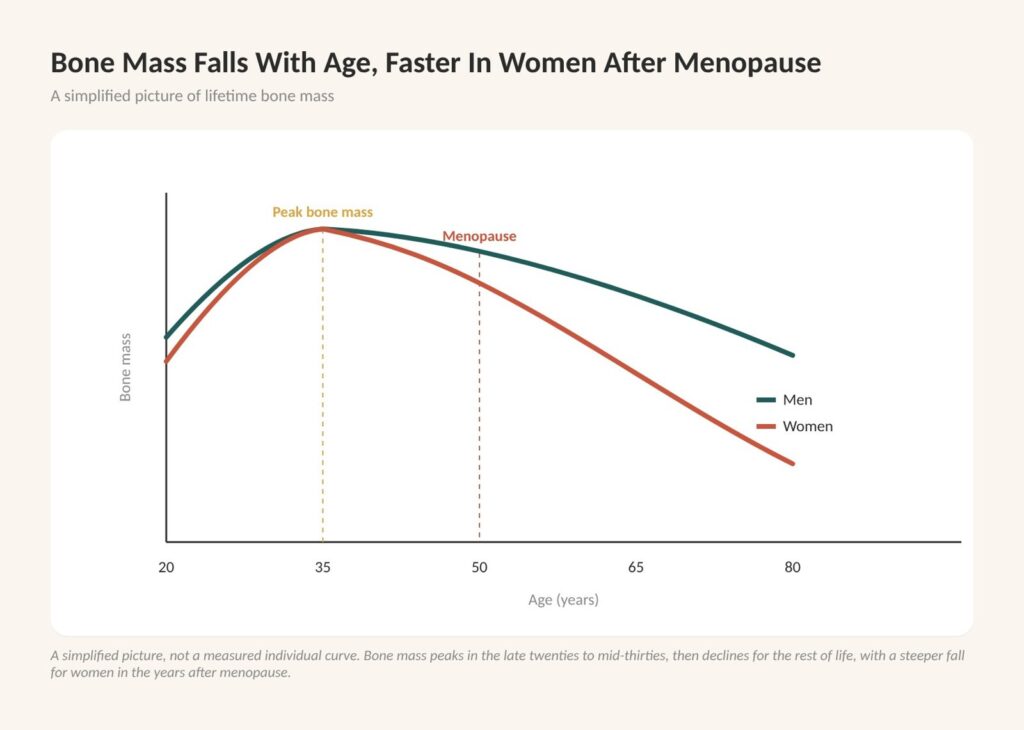 What is osteopenia? Chart of bone mass peaking in early adult life and falling with age, faster in women after menopause